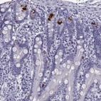 Immunohistochemical staining of human duodenum shows strong cytoplasmic positivity in enteroendocrine cells.