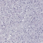 Immunohistochemical staining of human liver shows no positivity in hepatocytes as expected.