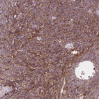 Immunohistochemical staining of human ovary shows strong positivity in extracellular matrix in stromal cells.