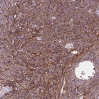 Immunohistochemical staining of human ovary shows strong positivity in extracellular matrix in stromal cells.