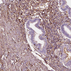 Immunohistochemical staining of human endometrium shows moderate positivity in extracellular matrix in stromal cells.