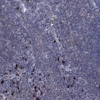 Anti-PVR Antibody