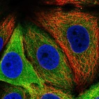 Immunofluorescent staining of human cell line MCF7 shows localization to cytosol.