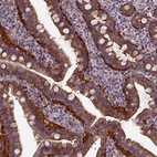 Immunohistochemical staining of human small intestine shows high expression.