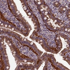 Immunohistochemical staining of human small intestine shows high expression.