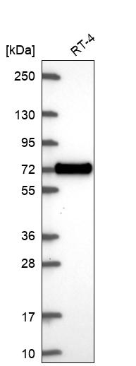 Anti-XKR6 Antibody