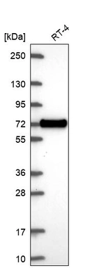 Anti-XKR6 Antibody
