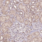Anti-ZBTB4 Antibody