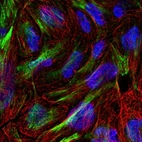 Immunofluorescent staining of human cell line RT4 shows localization to actin filaments.