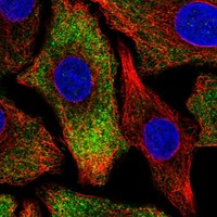 Anti-PNPLA6 Antibody