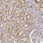 Anti-RNF13 Antibody