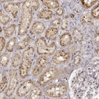 Anti-RNF13 Antibody