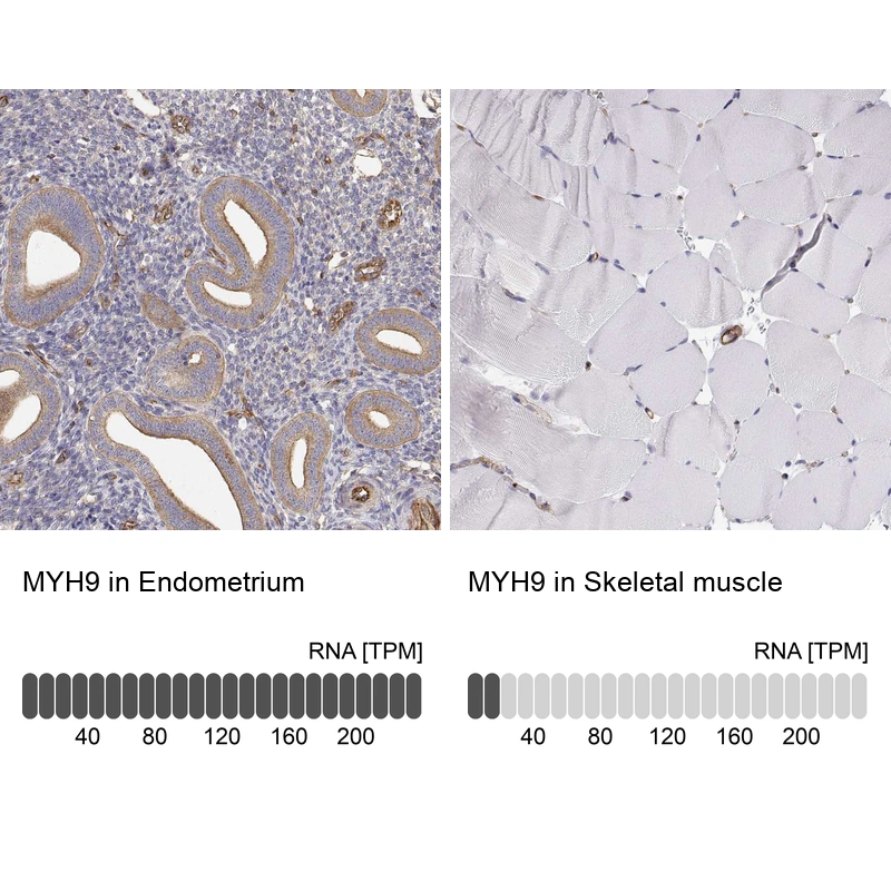 Rabbit Polyclonal Anti-MYH9 Antibody - Buy for research - Highly ...