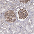 Immunohistochemical staining of human kidney shows moderate to strong cytoplasmic positivity in cells in glomeruli.