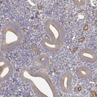 Immunohistochemical staining of human endometrium shows moderate membranous positivity in glandular cells.