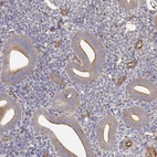 Immunohistochemical staining of human endometrium shows moderate membranous positivity in glandular cells.