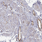 Immunohistochemical staining of human smooth muscle shows moderate cytoplasmic positivity in muscle fibres and endothelial cells.