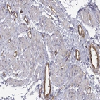 Immunohistochemical staining of human smooth muscle shows moderate cytoplasmic positivity in muscle fibres and endothelial cells.