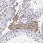 Immunohistochemical staining of human testis shows moderate cytoplasmic/membranous positivity in Leydig cells.