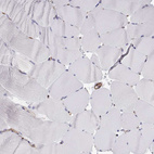 Immunohistochemical staining of human skeletal muscle shows no positivity in myocytes as expected.