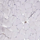Immunohistochemical staining of human skeletal muscle shows no positivity in myocytes as expected.