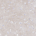 Immunohistochemical staining of human cerebral cortex shows moderate cytoplasmic positivity in neuropil.