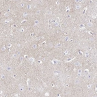 Immunohistochemical staining of human cerebral cortex shows moderate cytoplasmic positivity in neuropil.