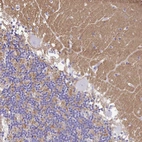 Immunohistochemical staining of human cerebellum shows moderate cytoplasmic positivity in neuropil.