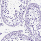 Anti-SYT1 Antibody