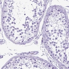Immunohistochemical staining of human testis shows no positivity in cells in seminiferous ducts as expected.