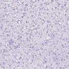 Immunohistochemical staining of human liver shows no positivity in hepatocytes as expected.