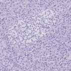 Immunohistochemical staining of human pancreas shows no positivity as expected.