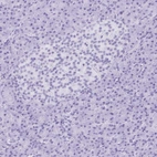 Immunohistochemical staining of human pancreas shows no positivity as expected.