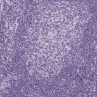 Immunohistochemical staining of human lymph node shows no positivity in germinal center cells as expected.