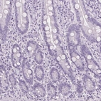Immunohistochemical staining of human small intestine shows no positivity in glandular cells as expected.