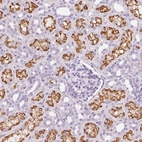Immunohistochemical staining of human kidney shows strong membranous positivity in cells in tubules.