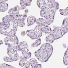 Immunohistochemical staining of human placenta shows no positivity in trophoblastic cells as expected.