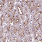 Immunohistochemical staining of human parathyroid gland shows strong membranous positivity in glandular cells.