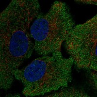 Anti-GSR Antibody