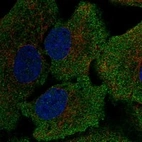 Anti-GSR Antibody
