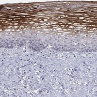 Anti-ALOX12 Antibody