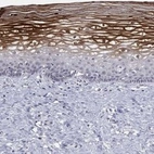 Anti-ALOX12 Antibody