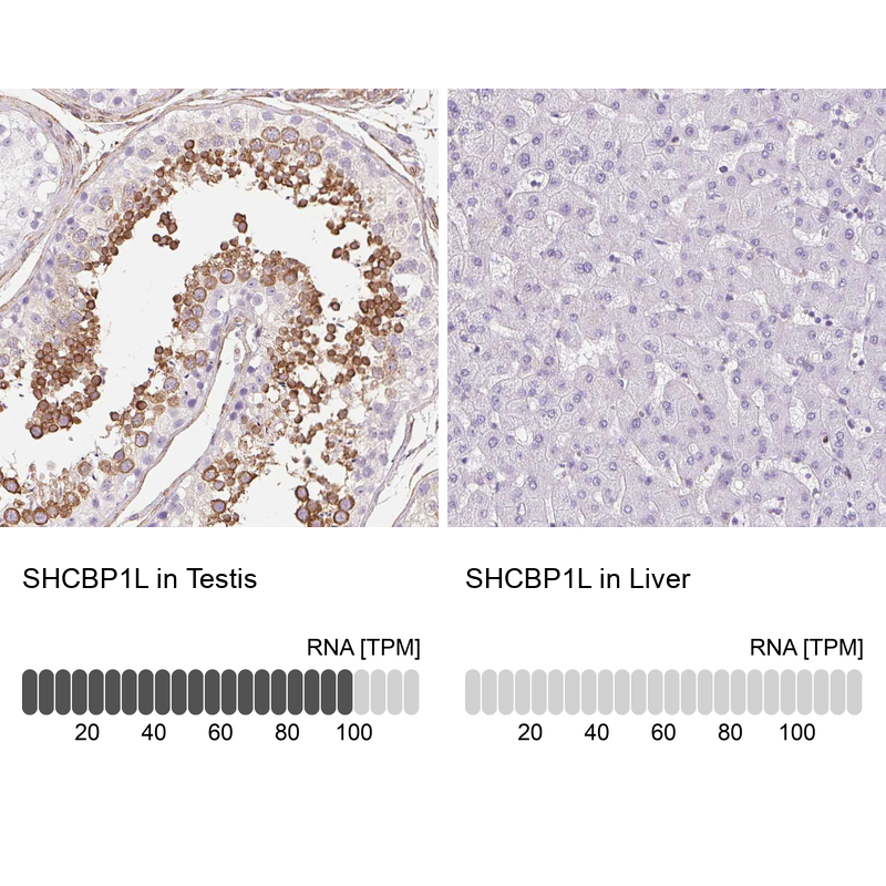 Anti-SHCBP1L Antibody