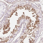 Immunohistochemical staining of human testis shows moderate cytoplasmic positivity in subset of cells in seminiferous ducts.