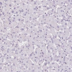 Immunohistochemical staining of human liver shows no positivity in hepatocytes as expected.