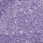 Immunohistochemical staining of human lymph node shows no positivity in germinal center cells as expected.
