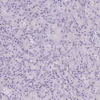 Anti-SHCBP1L Antibody