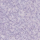 Immunohistochemical staining of human pancreas shows no positivity in exocrine glandular cells as expected.