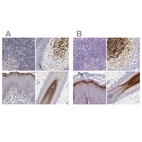 Immunohistochemical staining of human lymph node, skin, skin and skin, hairy using Anti-GSDMA antibody HPA064826 (A) shows similar protein distribution across tissues to independent antibody HPA023313 (B).