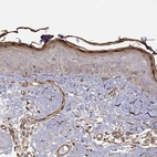 Immunohistochemical staining of human skin shows high expression.
